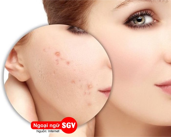 Vết thâm tiếng Nhật là gì